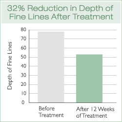 Fine Line Depth Reduction Chart