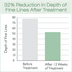 Fine Line Depth Reduction Chart Fine Line Depth Reduction Chart