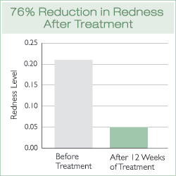 Redness Reduction Chart